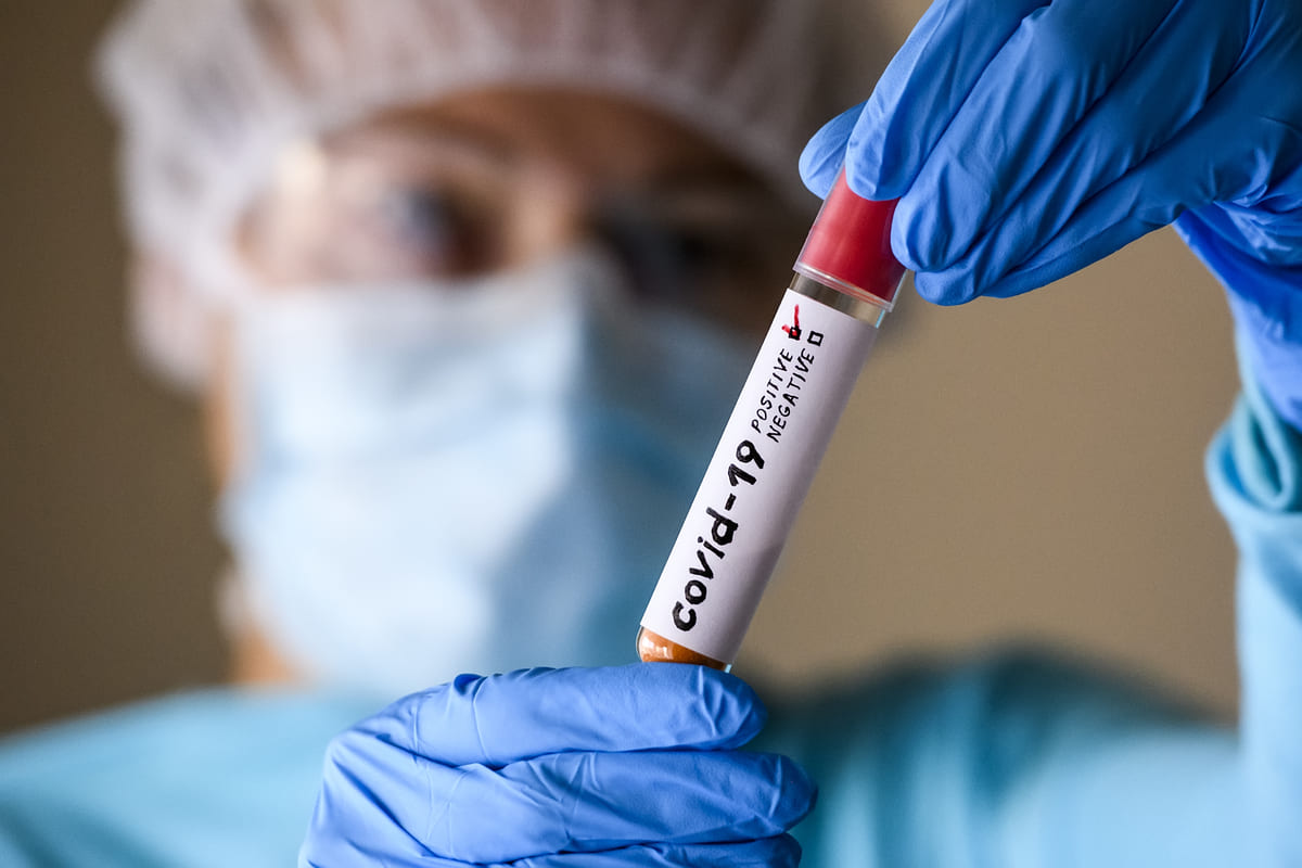 8 semelhanças entre a covid-19 e a gripe espanhola | Revista Quero