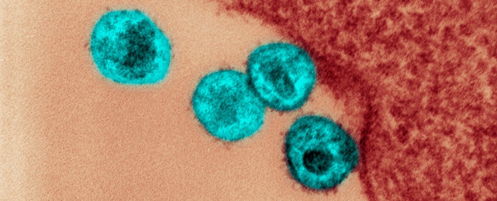 Algumas vacina candidatas à COVID-19 podem tornar as pessoas mais vulneráveis ao HIV, alertam os cientistas
