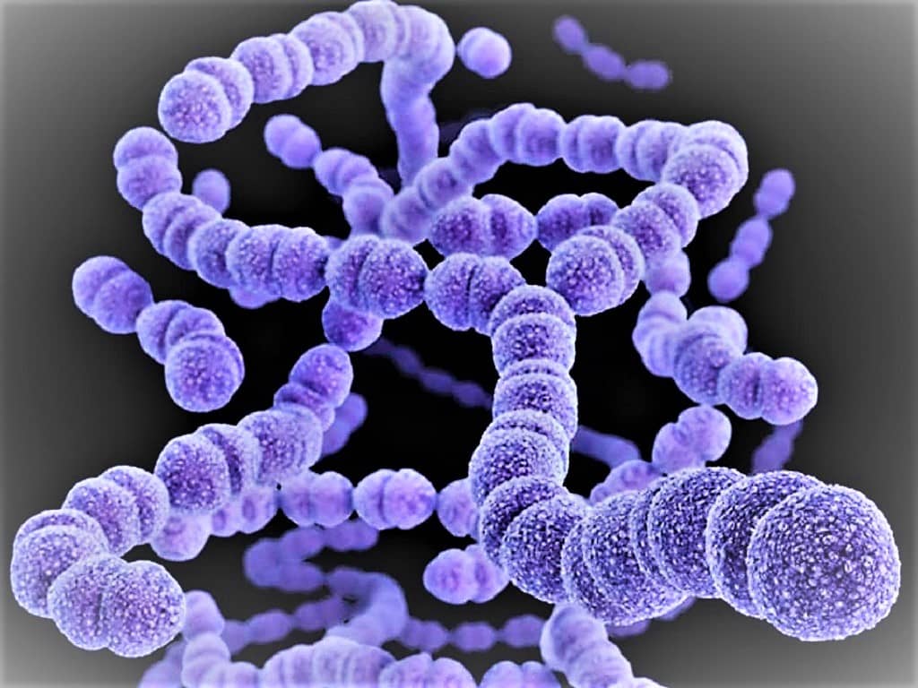 Morphology & Culture Characteristics of Streptococcus pyogenes
